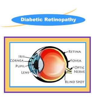 Diabetic Retinopathy Screening Program at Med North Health Center